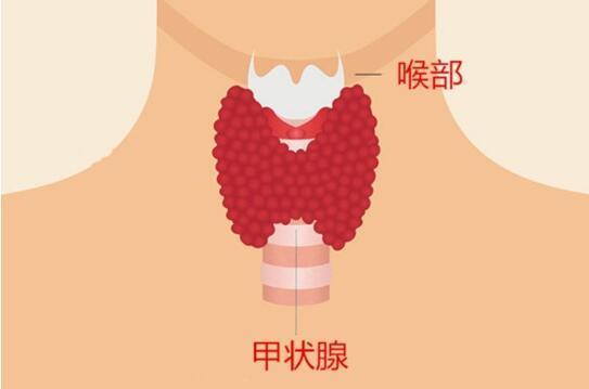 甲状腺结节